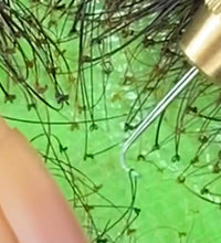Wig repair